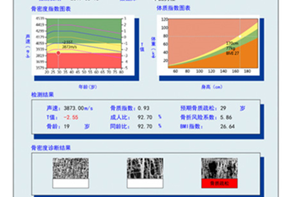 骨密度正常值對(duì)照表