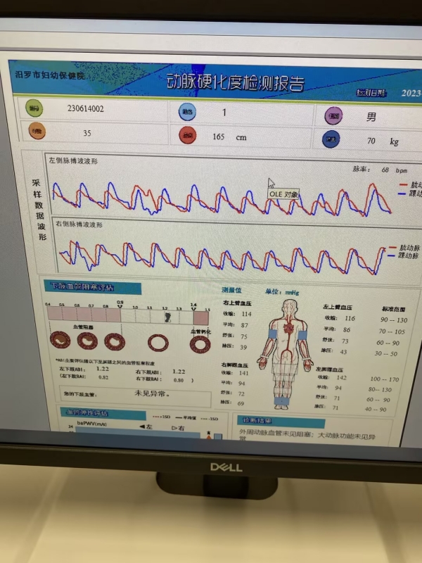 動脈硬化檢測儀：心血管疾病預防和治療的重要工具